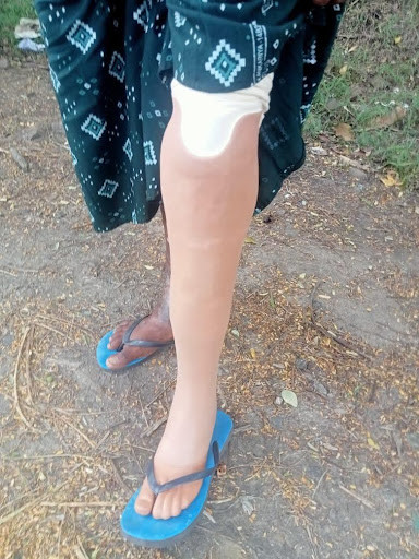 leg 2 leg 2